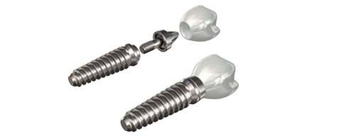 Dental Implants