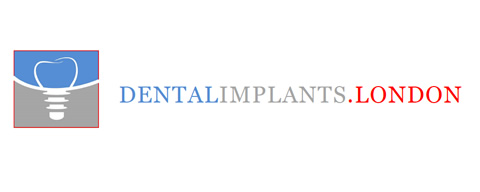 Dental Implants London